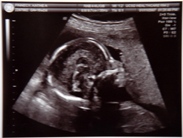18 weeks