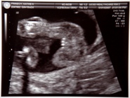 18 weeks