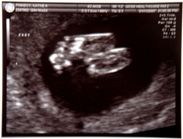 18 weeks