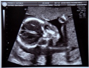 18 weeks