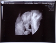 18 weeks