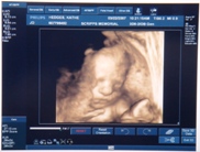 18 weeks