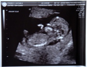 12 weeks