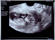 12 weeks