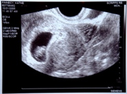 8 weeks